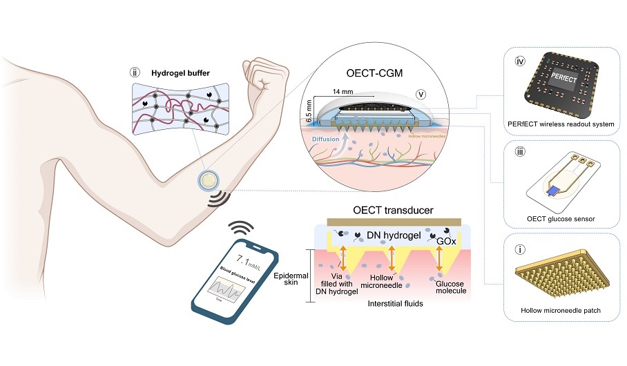 Imagen: El concepto y principio de diseño del sistema OECT-CGM (Foto cortesía de Science Advance; doi: 10.1126/sciadv.adl18)